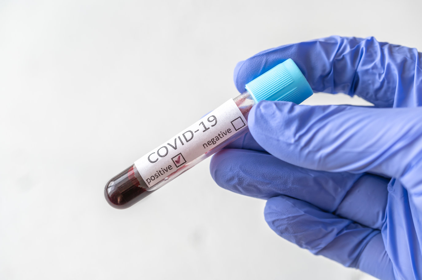Coronavirus: Zeci de teste fals pozitive