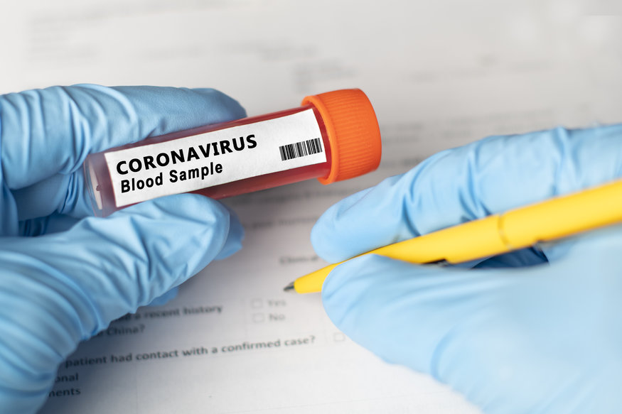 Pacienții care ar putea dezvolta o formă gravă de Covid-19 pot fi depistați pe baza unui test de sânge