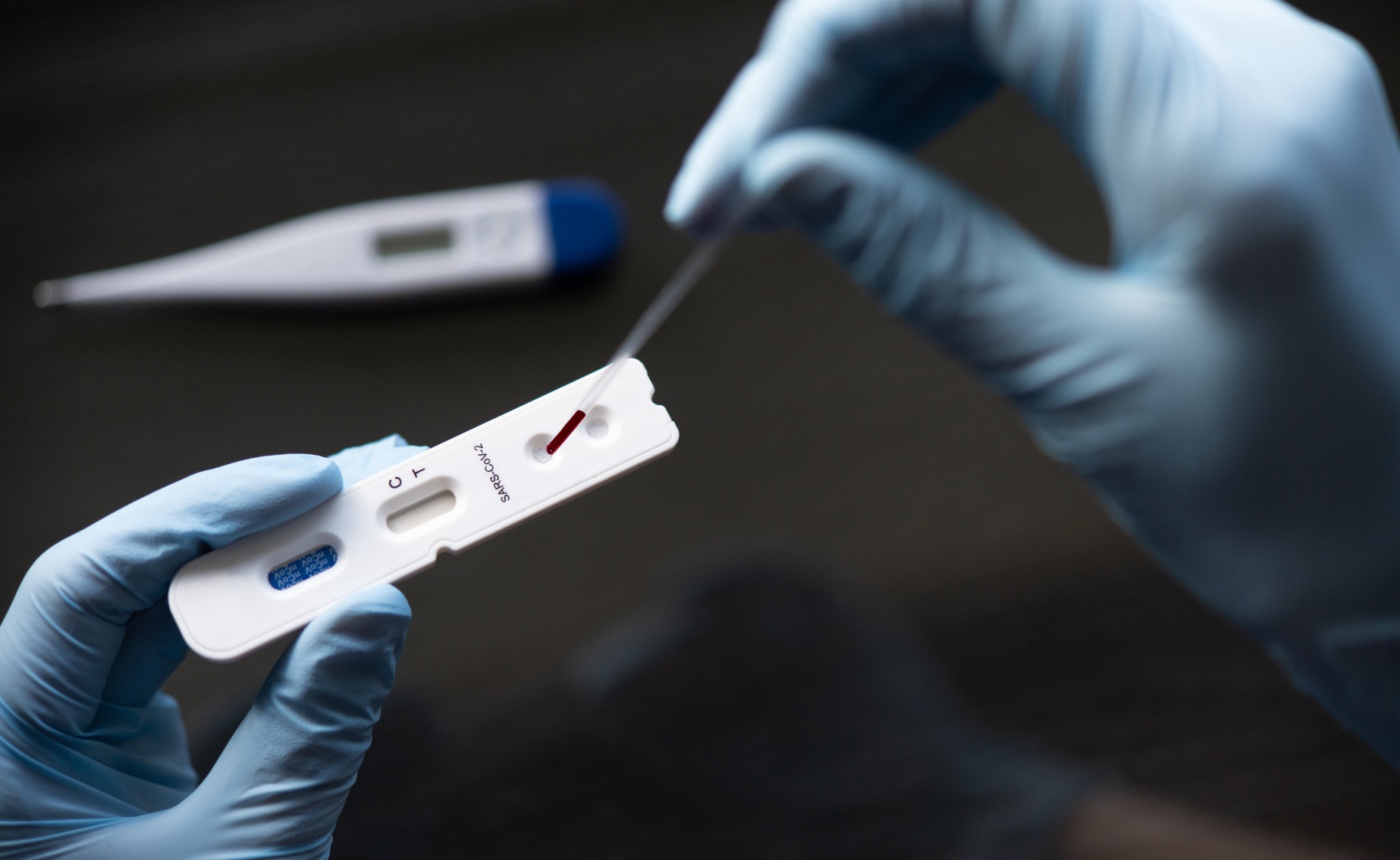 Coronavirus | Farmaciile din Franța au autorizația să efectueze teste serologice rapide