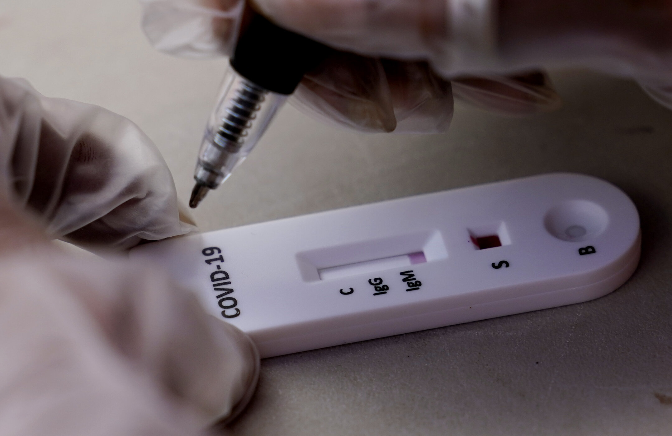 Testele de anticorpi Covid-19 nu sunt concludente în stabilirea dimensiunii epidemiei. Mult mai multe persoane au fost deja infectate