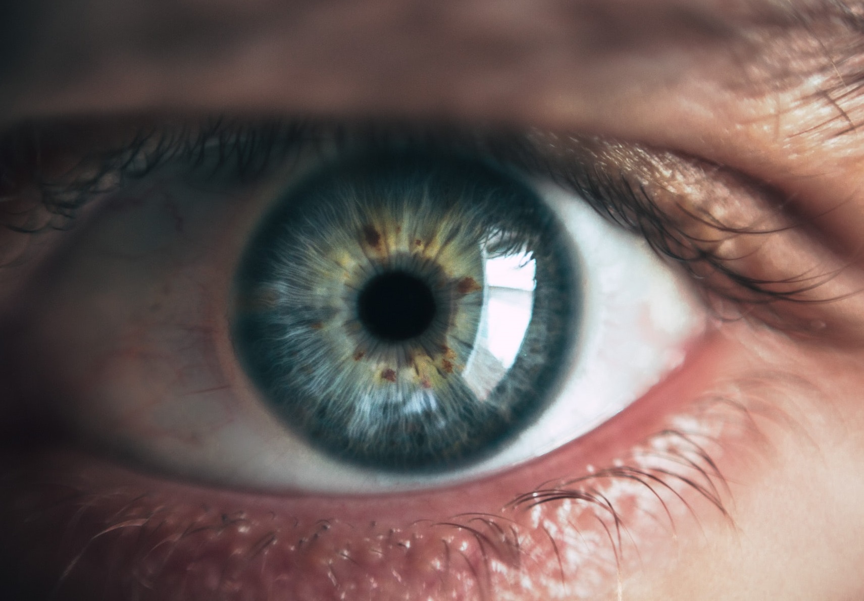 Un nou simptom Covid: durere în zona ochilor. „Nu este vorba despre o simplă conjunctivită”