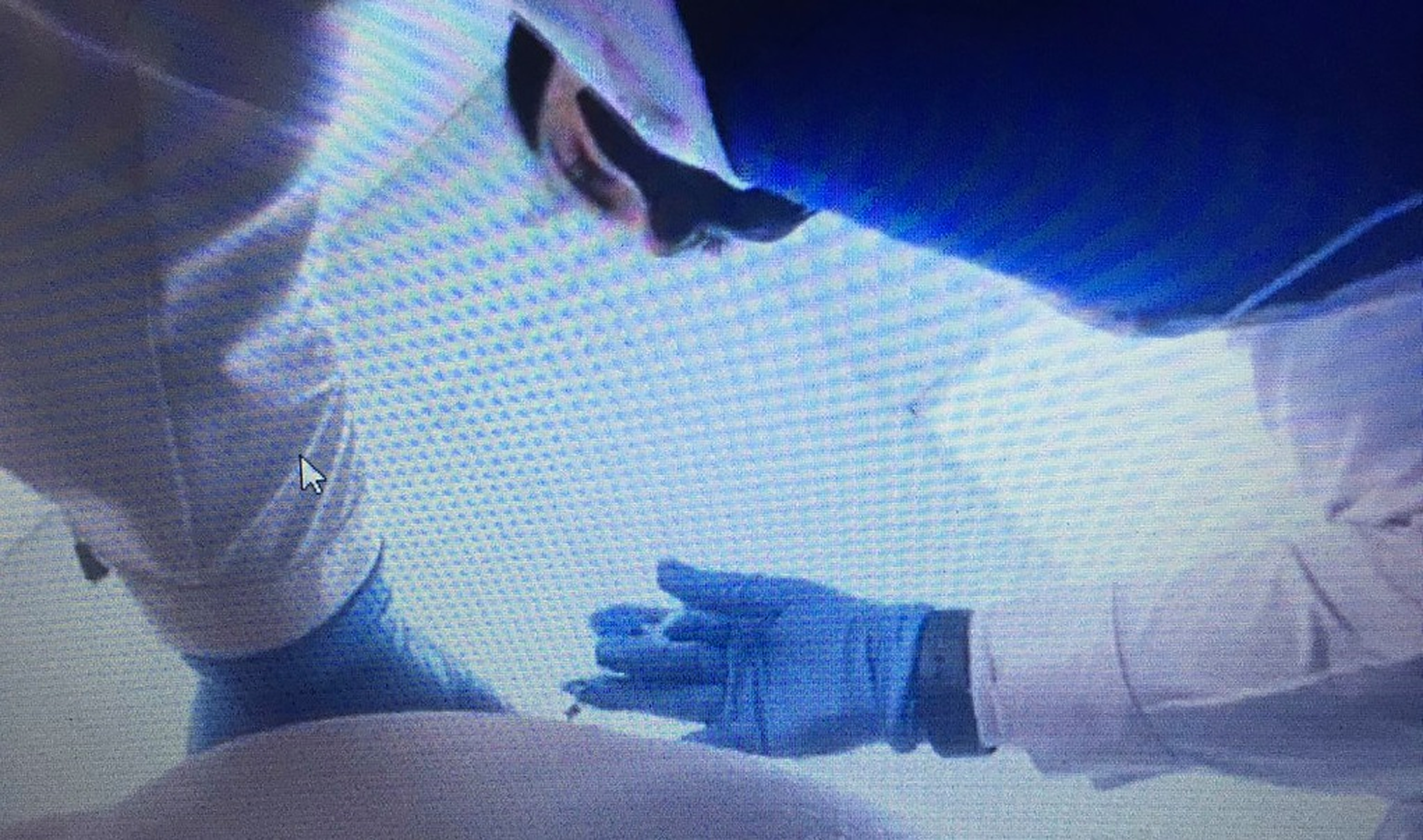 O asistentă audiată de judecător prin videoconferință transmite imagini cu posteriorul unui pacient, în timp ce îi administrează o injecție
