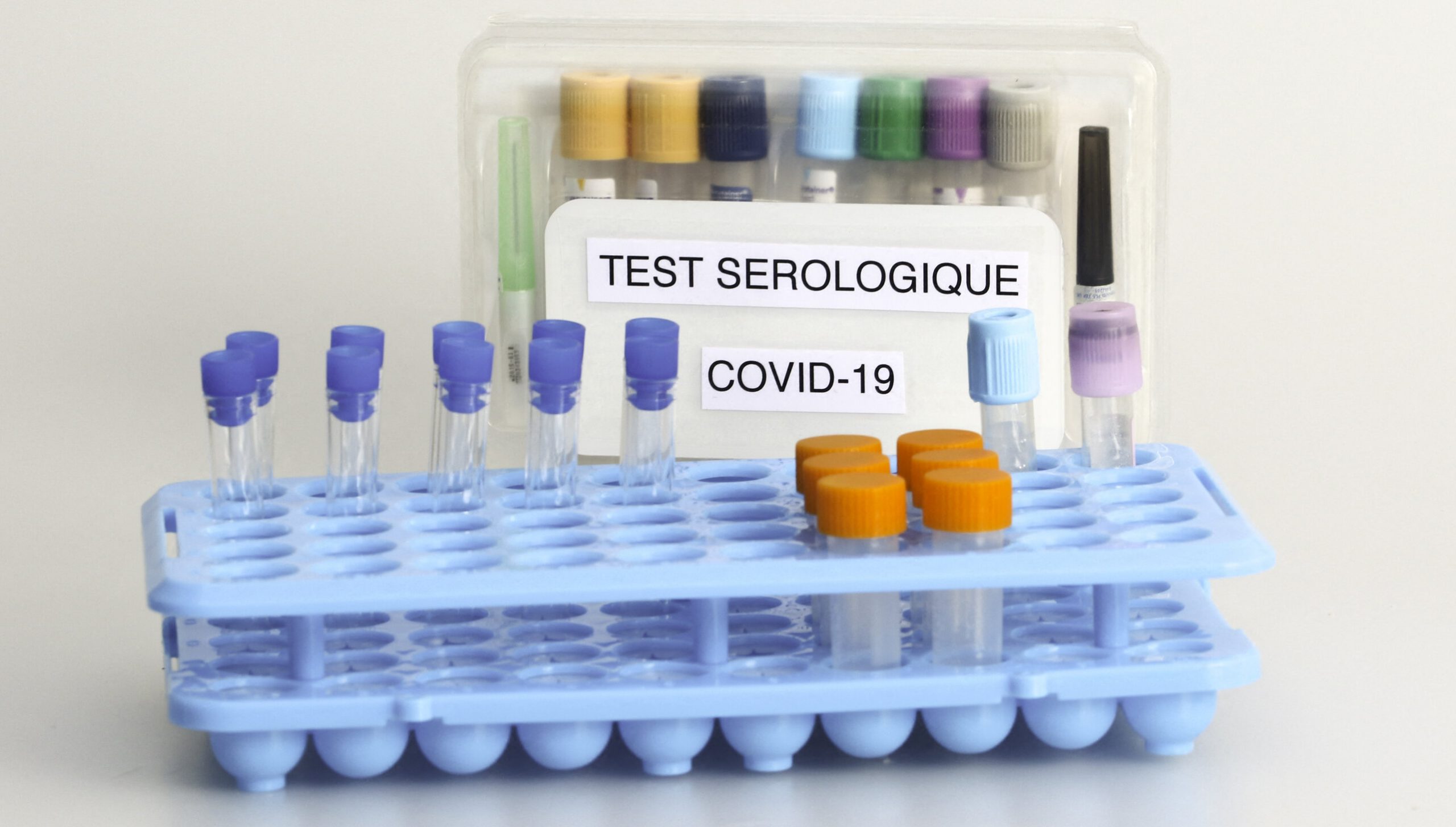 Franța| Autoritatea sanitară vrea testare serologică înainte de vaccinare. Cei cu anticorpi primesc o singură doză a serului anti-Covid